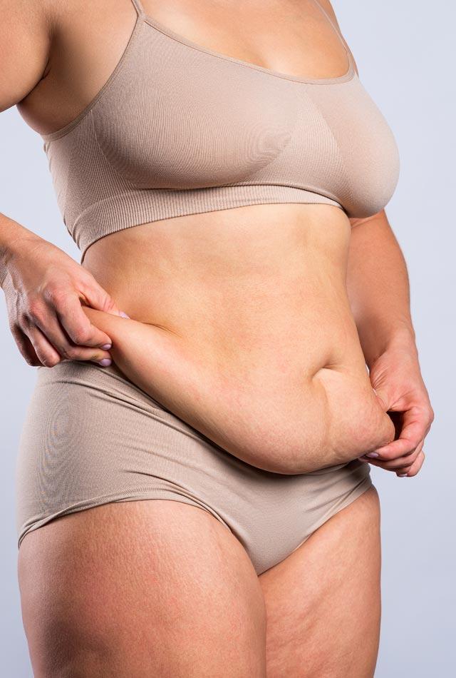 Understanding Belly Fat and Its Impact on Health