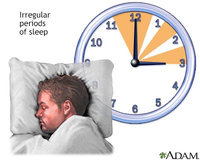 6) Irregular Sleep Patterns: Sticking to rigid work hours can disrupt your natural sleep cycle, affecting energy and overall well-being