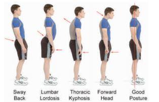 3) Poor Posture: Slouching in your chair can result in back pain and posture issues that affect overall health