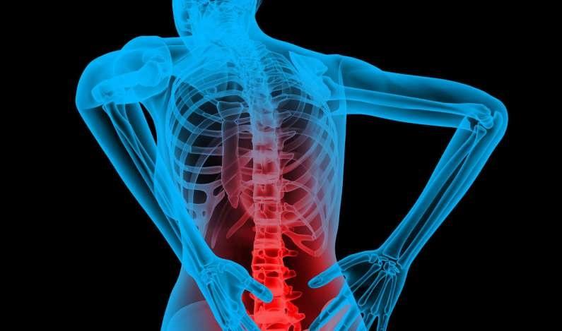 Is Working Out ​Hurting Your ​Back